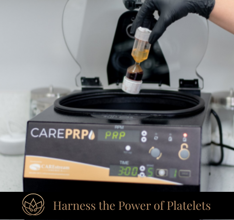 PRP Skin Rejuvenation: The Natural Way to Renew, Restore, and Revive Your Skin