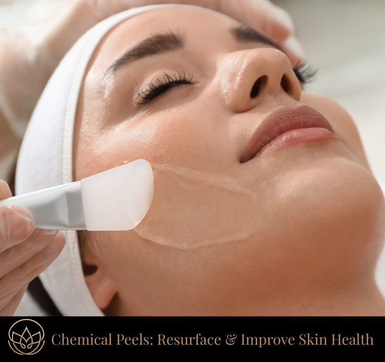 Chemical Peels by AlumierMD