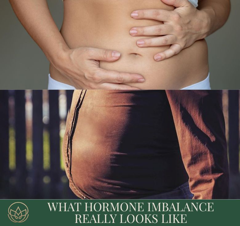 What Hormone Imbalance Really Looks Like (Men & Women)